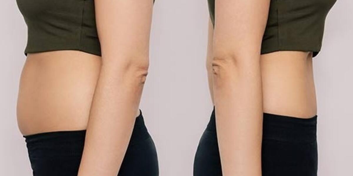 Wegovy or Ozempic for effective weightloss in Javea